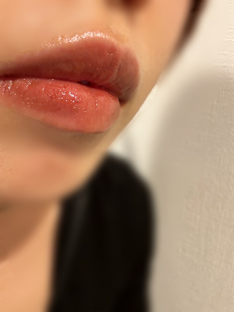投稿写真