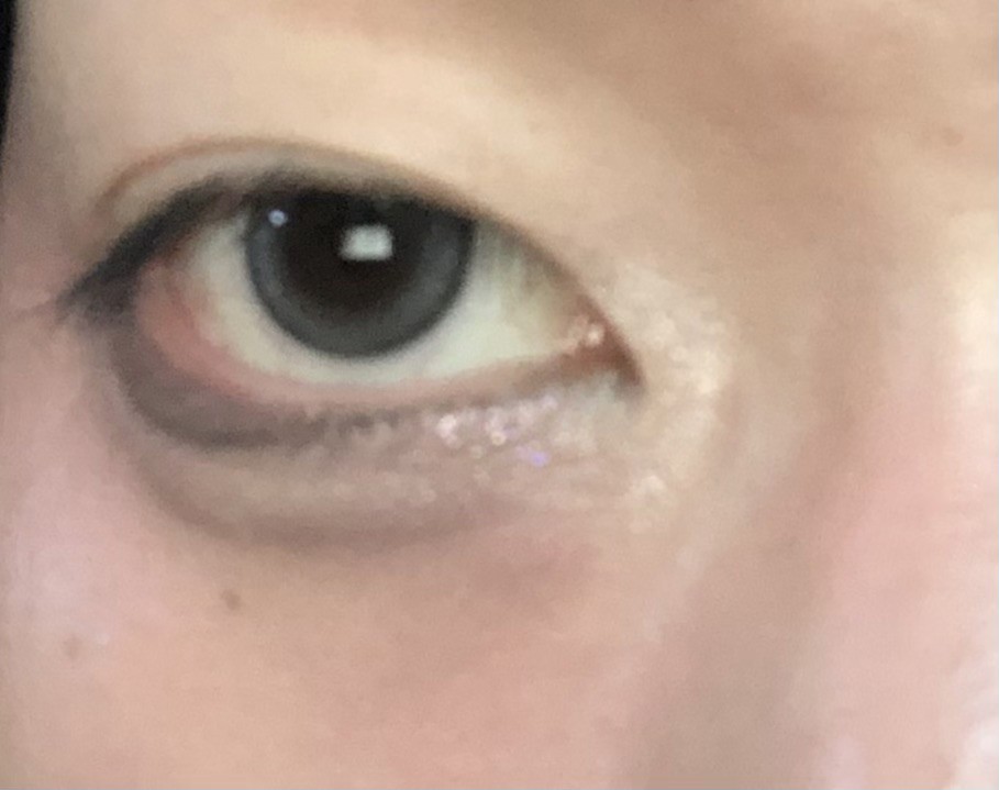 ユーザー写真